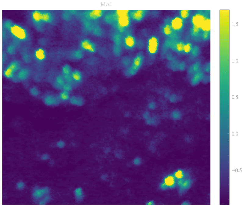MAI: hot spots de atividade (proxy NADH).